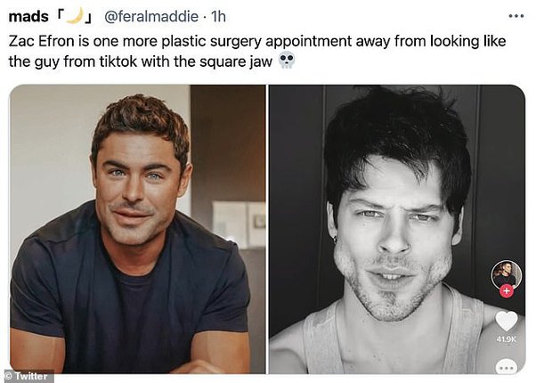 Zack, wearing a navy blue shirt, after his jaw surgery; tik-tok's square jaw shaped guy