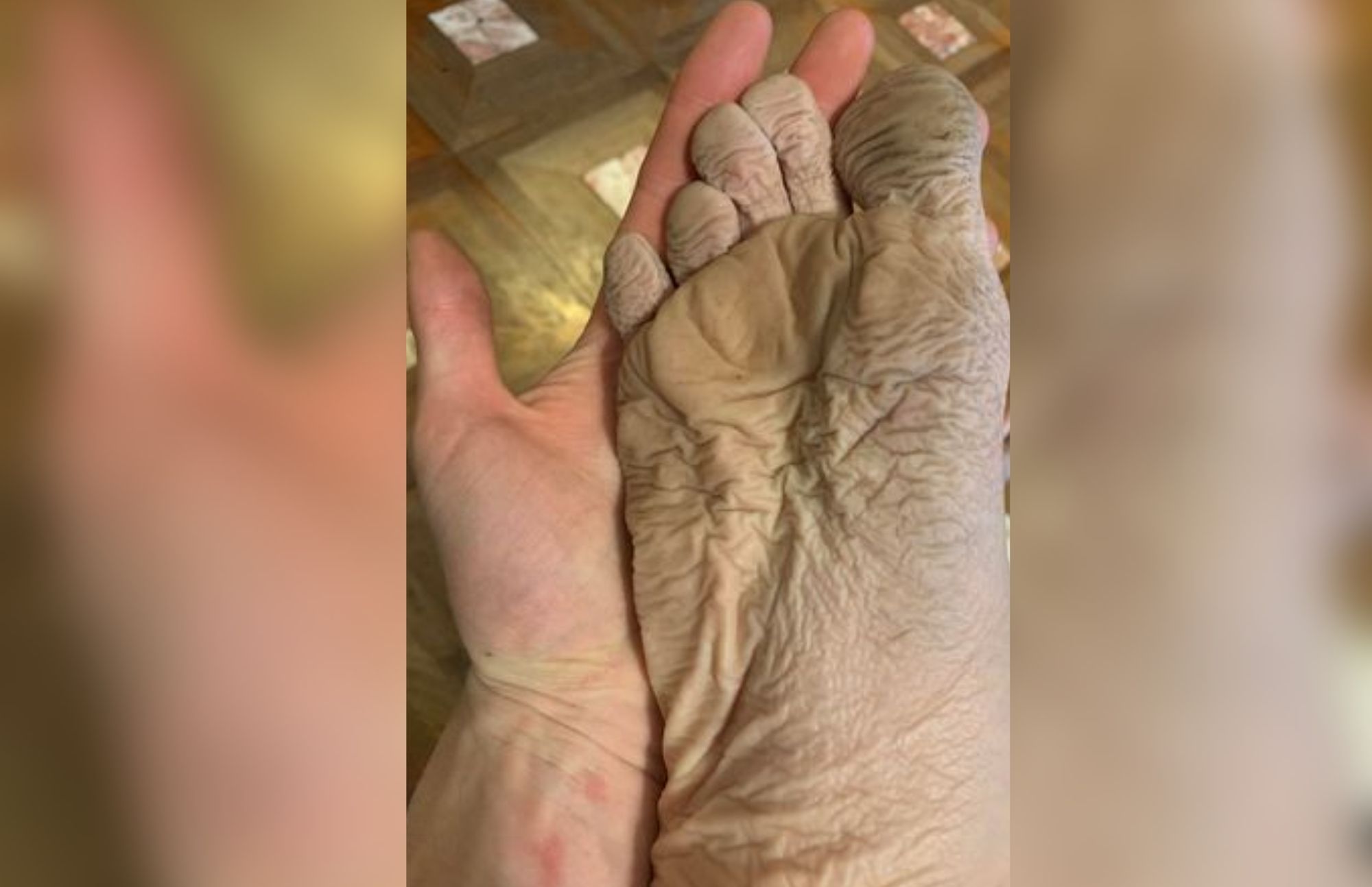 A foot that has wrinkled skin and is turning a light brown color