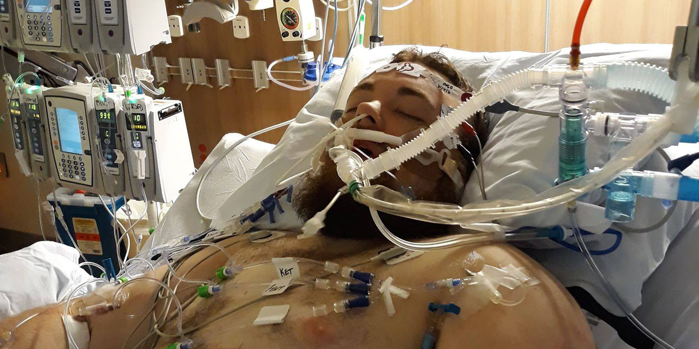 A man in the hospital due to lung complications