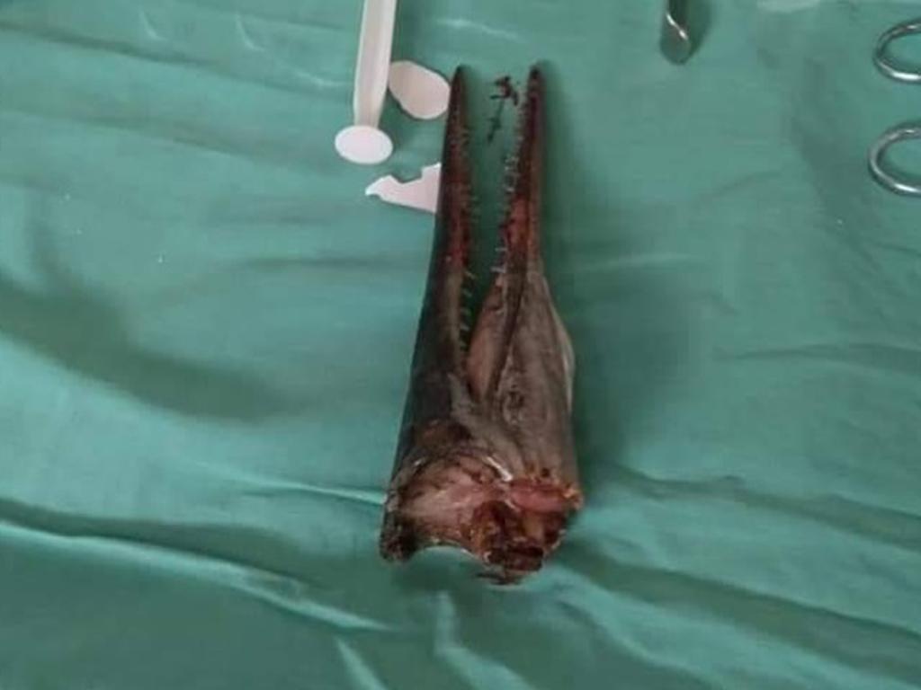 Needlefish upper body after the operation