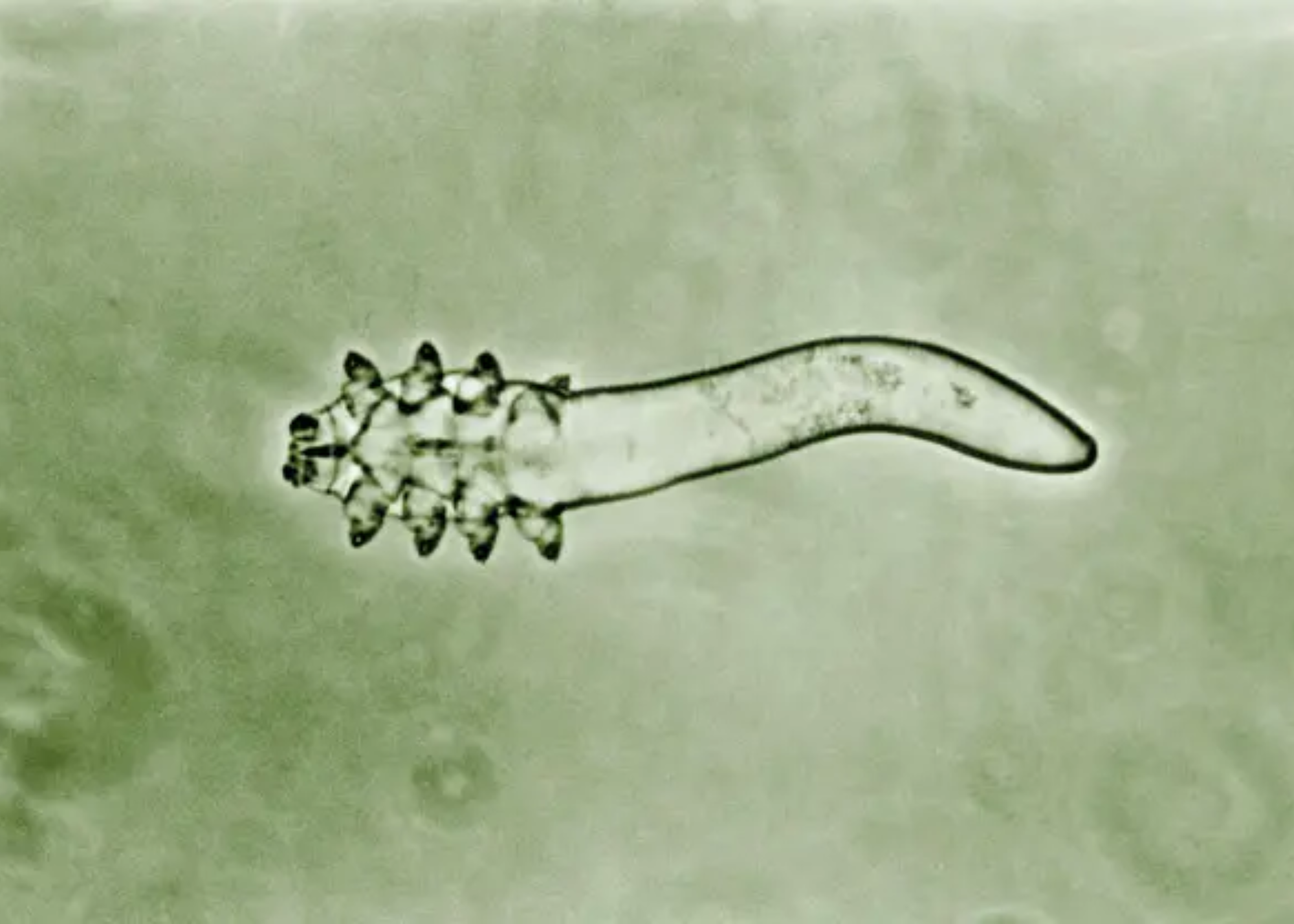 The eight-legged Demodex folliculorum mites