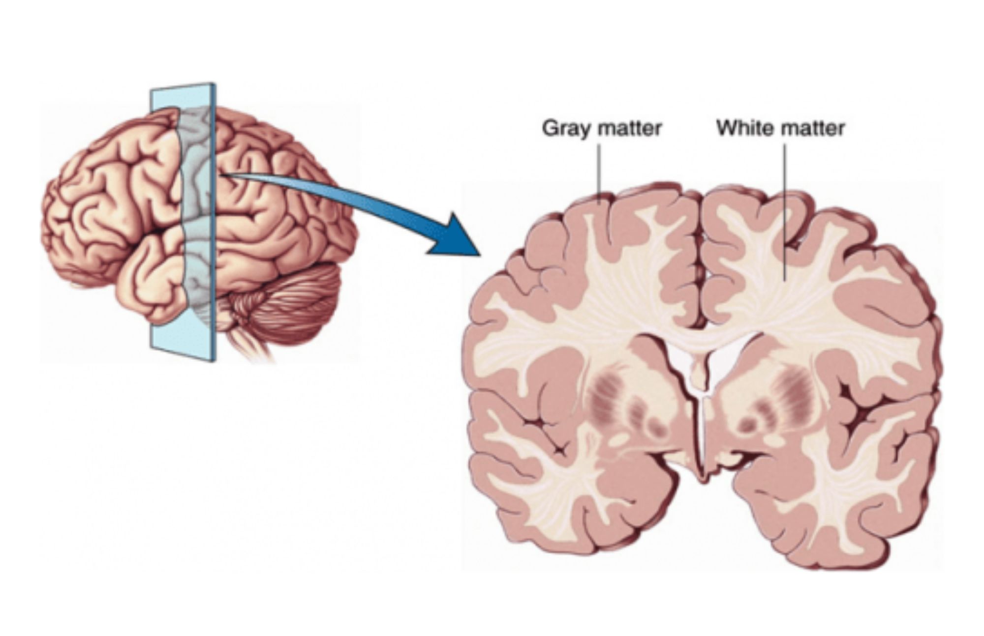 A whole human brain is shown on the left, while a cross section of a brain showing gray and white matter is shown on the right