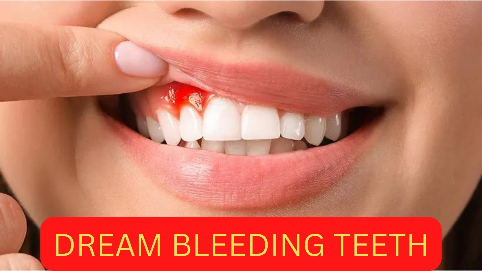 Dream Bleeding Teeth Symbolism - You Have Some Unhealed Wounds