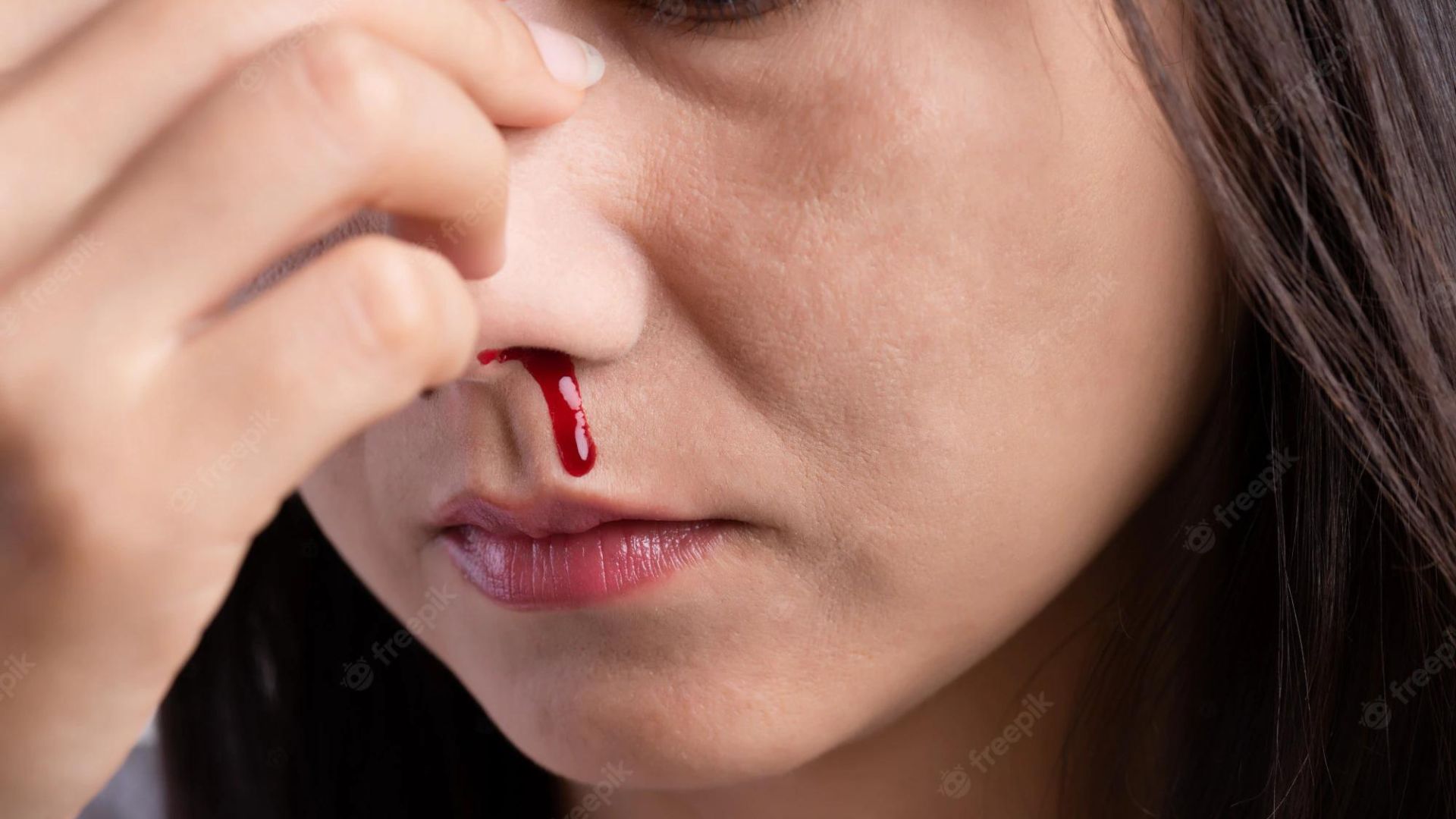 Woman's Nose bleeding