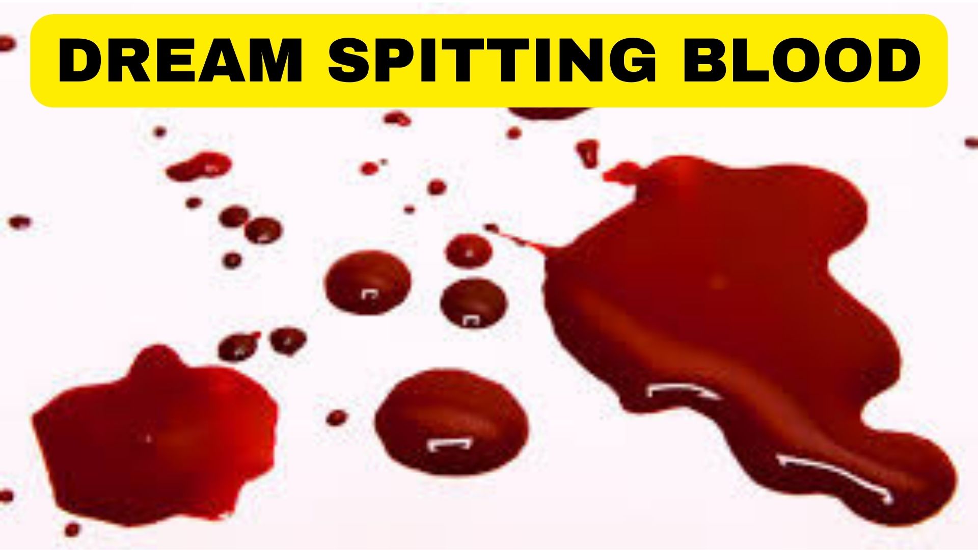 Dream Spitting Blood - It Portends Sudden Reversal Of Fortune