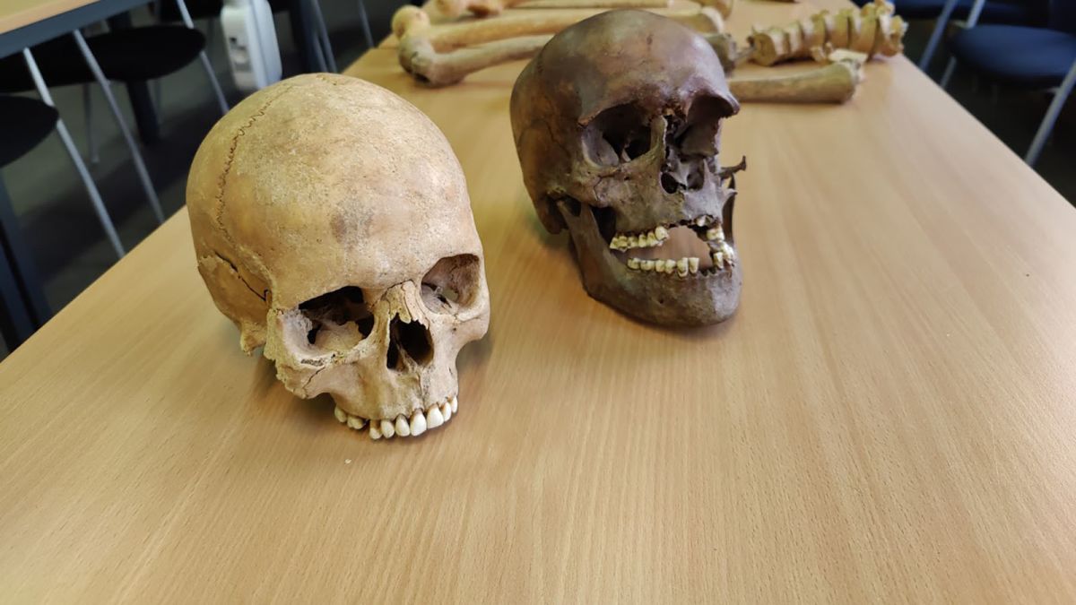 Two skulls and some bones of Waterloo Battle soldiers