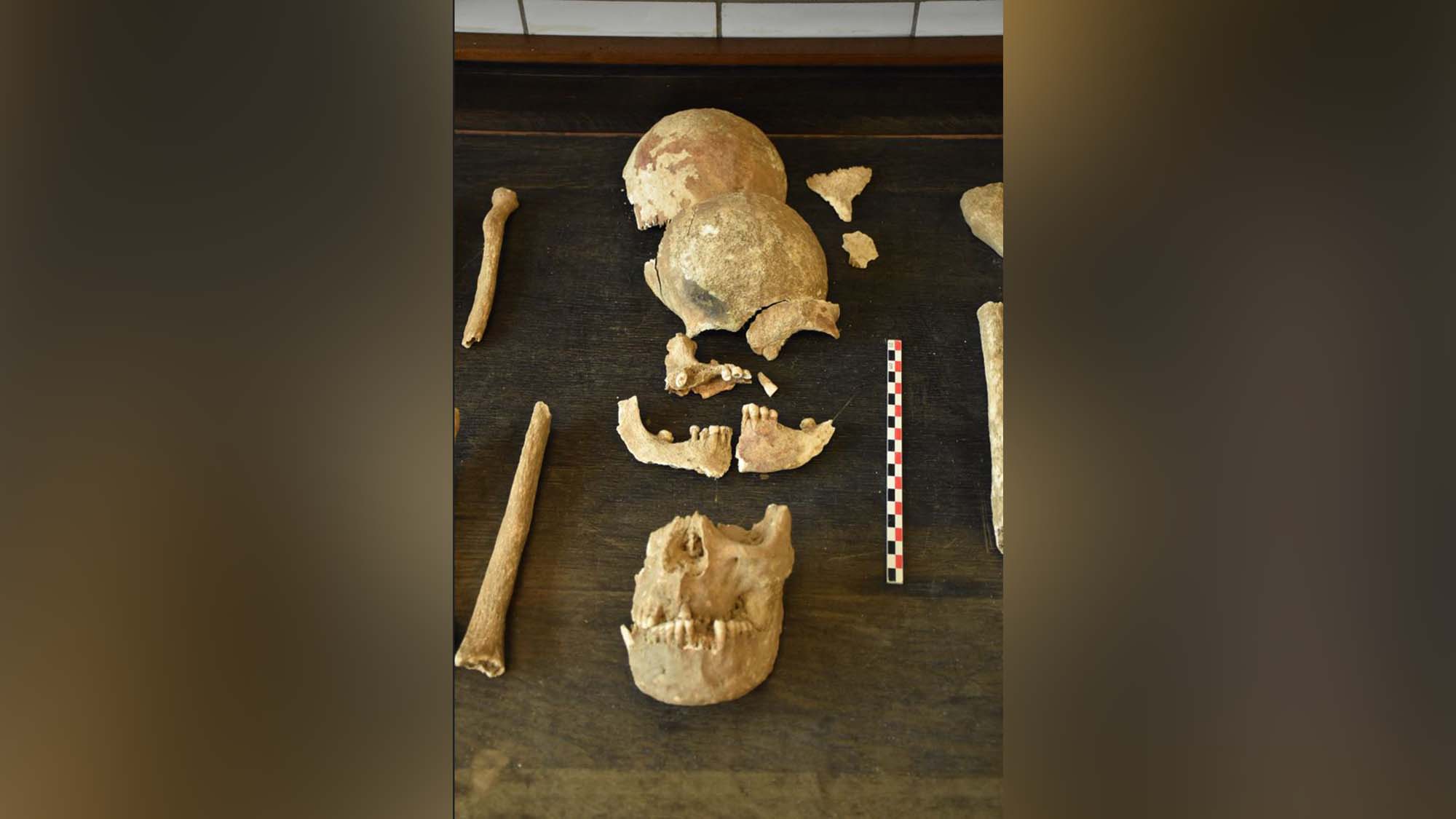 Battle Of Waterloo Skeletons Found In The Attic In Belgium