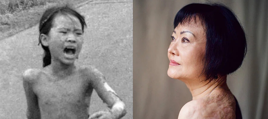 Napalm girl then vs. now