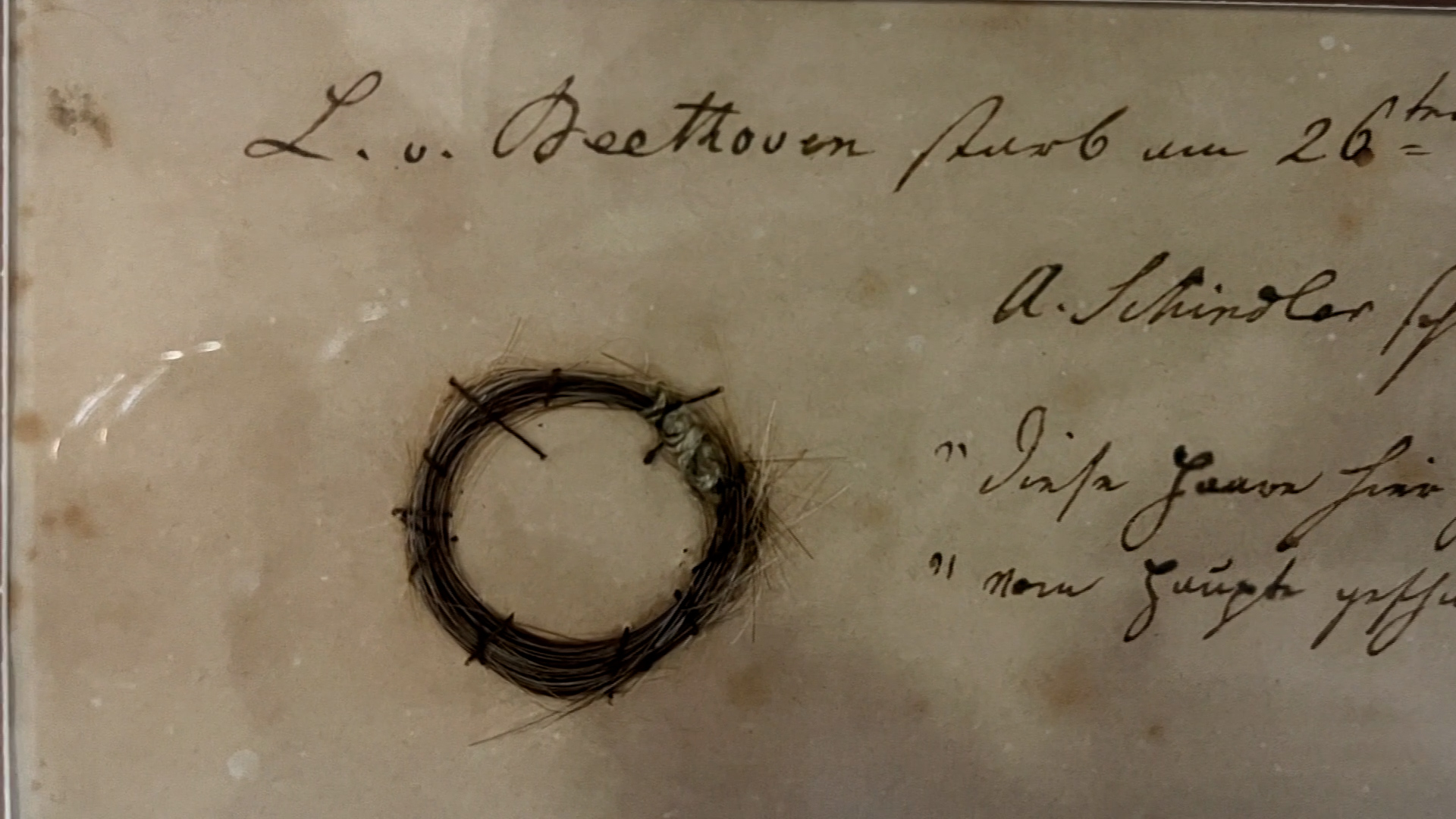 DNA From Beethoven’s Hair Tell Scientists About His Death