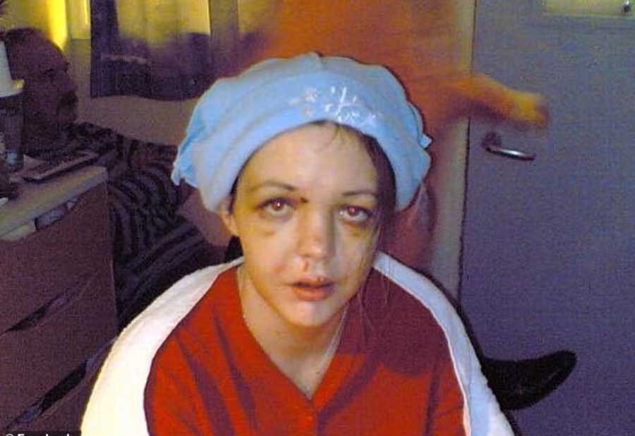 Gráinne Kealy after car crash