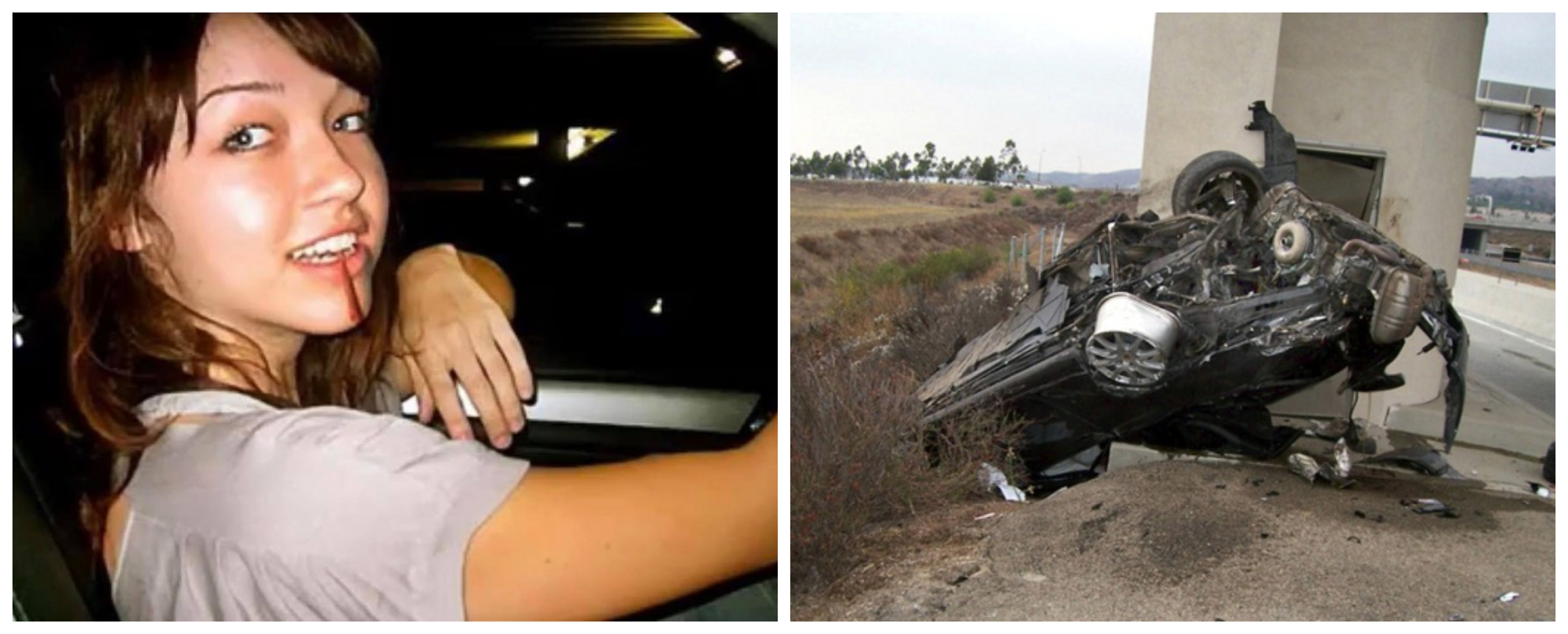 Nikki Catsura - Pictures Of Her Brutal Car Accident Gets Leaked