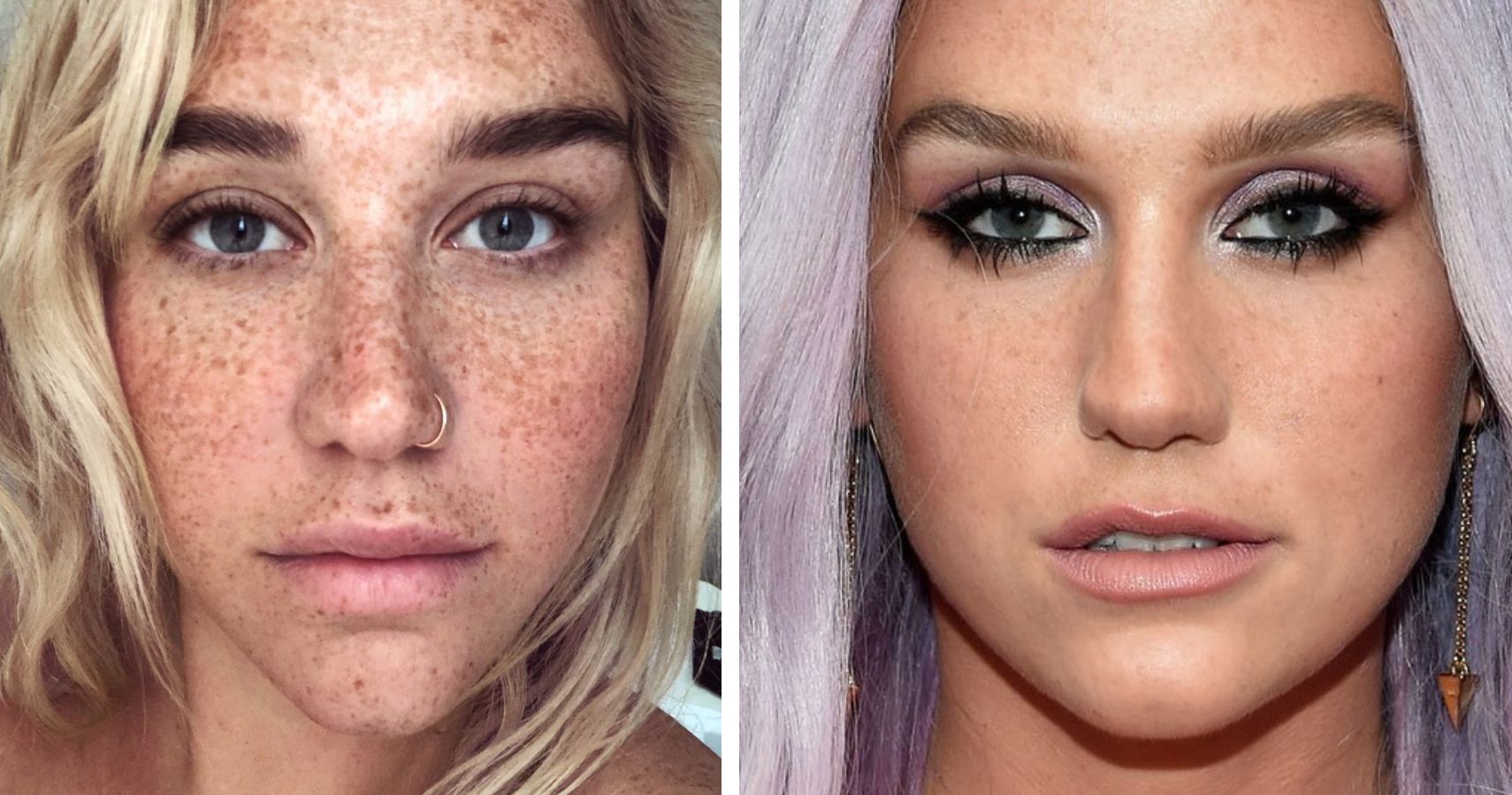 Kesha on the left has many freckles on her face, whereas Kesha on the right has makeup all over her face