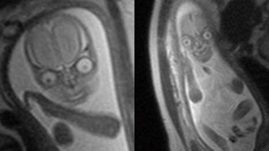 People Are Horrified After Seeing MRI Images Of An Unborn Baby