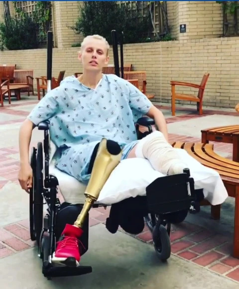 Lauren Wasser on a wheelchair, wearing a hospital gown.
