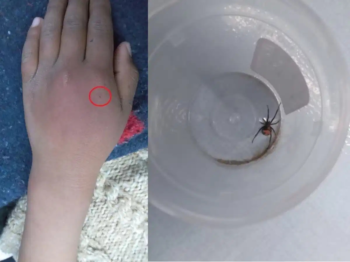 Young Boy Allows Black Widow Spider To Bite Him So He Can Turn Into Spider-Man