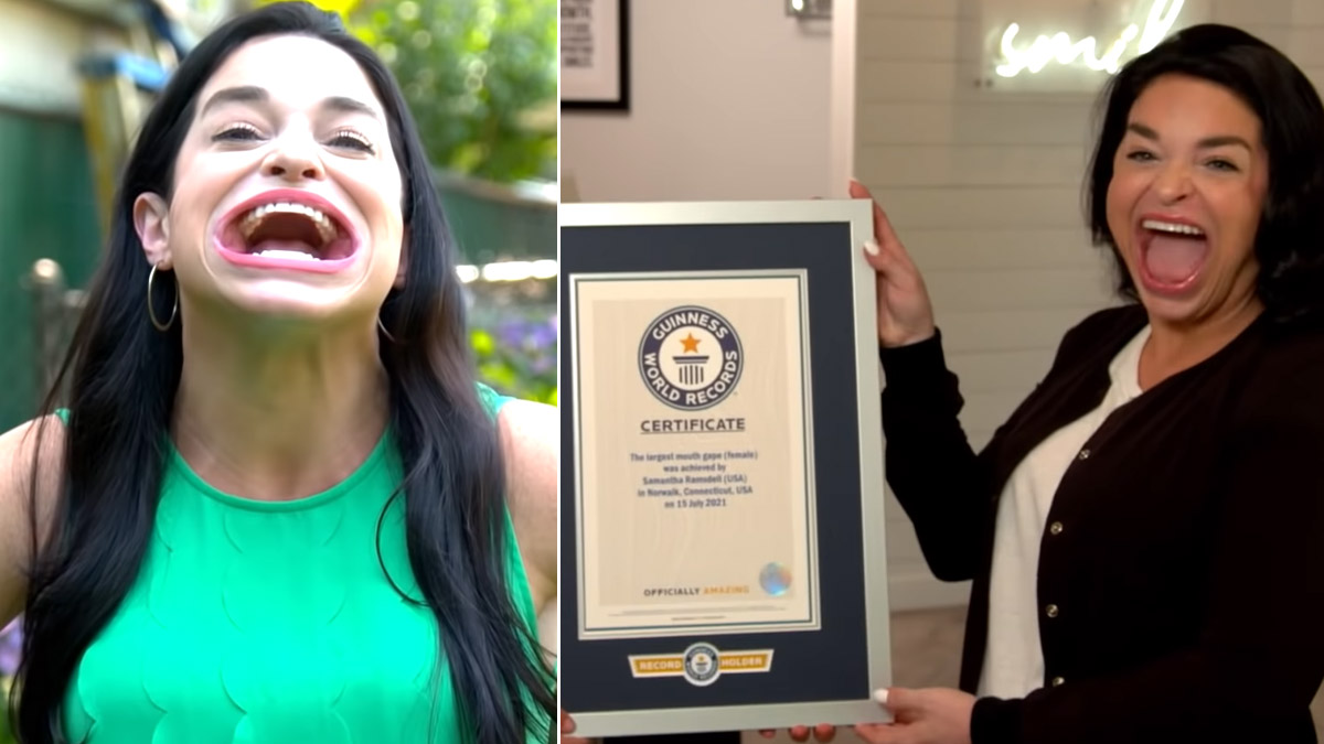 Woman With Largest Mouth Gape Sets Second Record In Guinness World Of Records