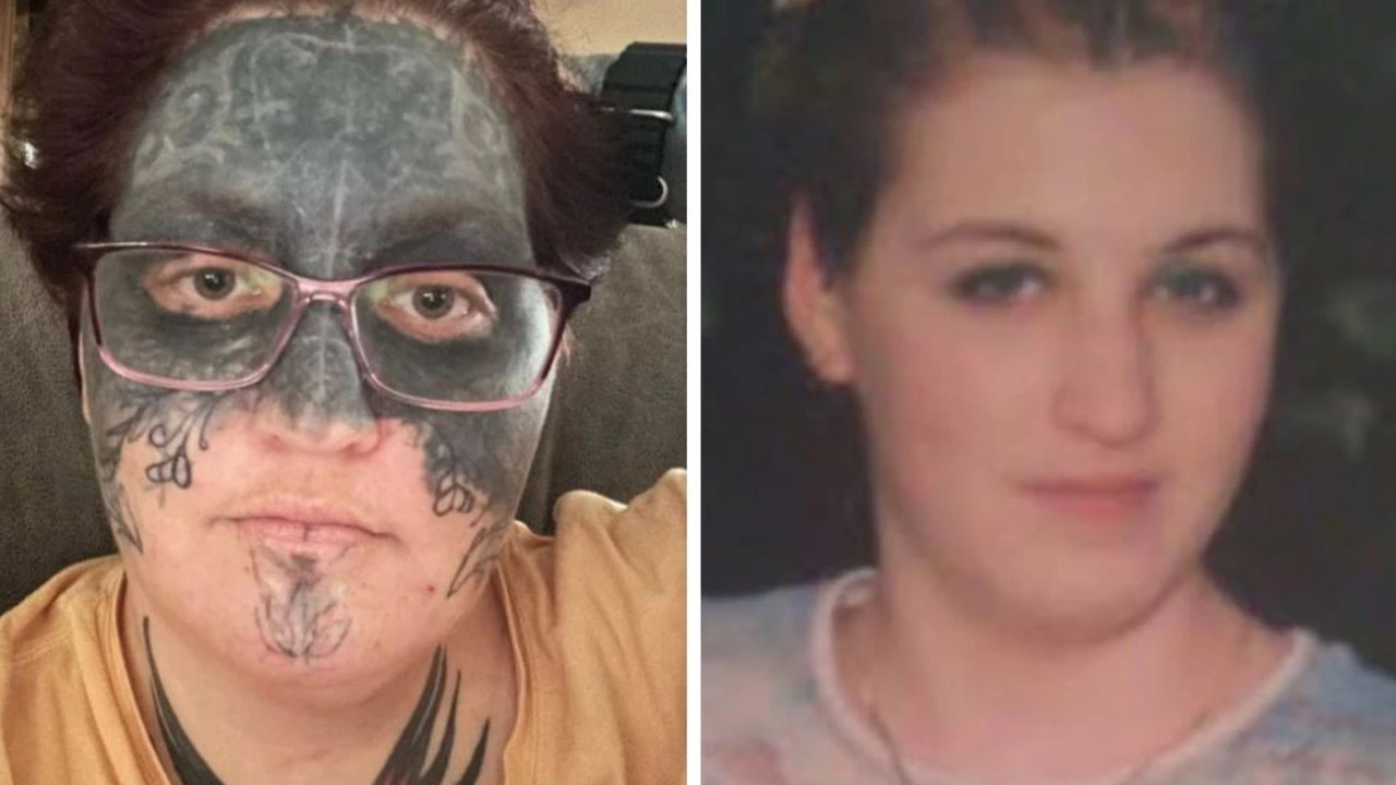 Woman Whose Face Was Tattooed Against Her Will Gets Tattoo Removal Thanks To A Complete Stranger